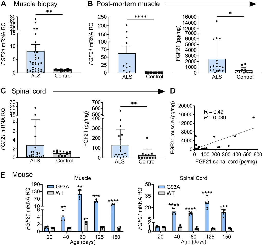 FGF21 levels are elevated in the muscle and spinal cord tissues of ALS patients and the SOD1G93A mouse. (A) FGF21 mRNA expression was analysed in normal (n = 24) and ALS (n = 36) muscle biopsy samples via RT-qPCR. **P = 0.004, unpaired two-tailed t-test with Welch’s correction. (B) FGF21 mRNA levels were quantified in normal (n = 7) and ALS (n = 11) post-mortem muscle samples (left panel) and FGF21 protein levels (n = 13 for normal samples; n = 18 for ALS samples; right panel). **P = 0.003, ****P  0.0001, two-tailed Mann Whitney test. (C) FGF21 mRNA levels were quantified in normal (n = 14) and ALS (n = 22) post-mortem spinal cord samples (left panel) and FGF21 protein levels (n = 12 for normal samples; n = 18 for ALS samples; right panel). **P = 0.00, two-tailed Mann Whitney test. (D) Comparison of spinal cord and muscle FGF21 protein levels for 18 ALS patients. A spearman correlation test was used for analysis. (E) FGF21 mRNA levels in the gastrocnemius muscle (left panel) and spinal cord (right panel) were quantified across different age groups (20 – 150 days; n = 4-5 per group) from SOD1G93A mice and littermate controls. **P  0.01, ***P  0.001, ****P  0.0001, unpaired two-tailed t-test comparing WT to SOD1G93A. For all graphs, error bars represent SD.
