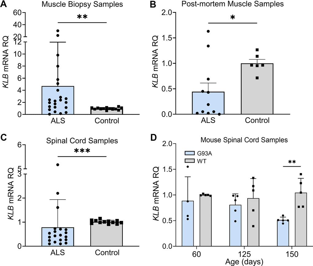 FGF21 coreceptor, β-Klotho (KLB), is dysregulated in ALS muscle and spinal cord. (A) KLB mRNA levels were measured in muscle biopsy samples from normal (n = 13) and ALS patients (n = 23). **P = 0.005, two-tailed Mann Whitney test. (B) KLB mRNA levels were measured in post-mortem muscle samples from normal controls (n = 6) and ALS (n = 11) patients. *P = 0.034, two-tailed Mann Whitney test. (C) KLB mRNA levels were measured in spinal cord samples from normal controls (n = 12) and ALS patients (n = 20). ***P = 0.0006, two-tailed Mann Whitney test. (D) KLB mRNA levels were measured in spinal cord samples from SOD1G93A mice (n = 5) and WT controls (n = 5) at different ages. **P = 0.003; unpaired two-tailed t-test comparing WT to SOD1G93A.