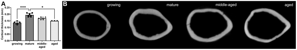 MicroCT analysis of the femur cortical thickness at midshaft, for the 4 age groups. (A) Comparison of the cortical bone thickness at mid-diaphysis between the 4 groups. (B) Transversal microCT images of the femur mid-diaphysis of mice from the 4 age groups. The data are presented as mean ± s.d. Statistical analyses: KW, Dunn’s multiple comparison test with the mature group as reference, *p ***p 