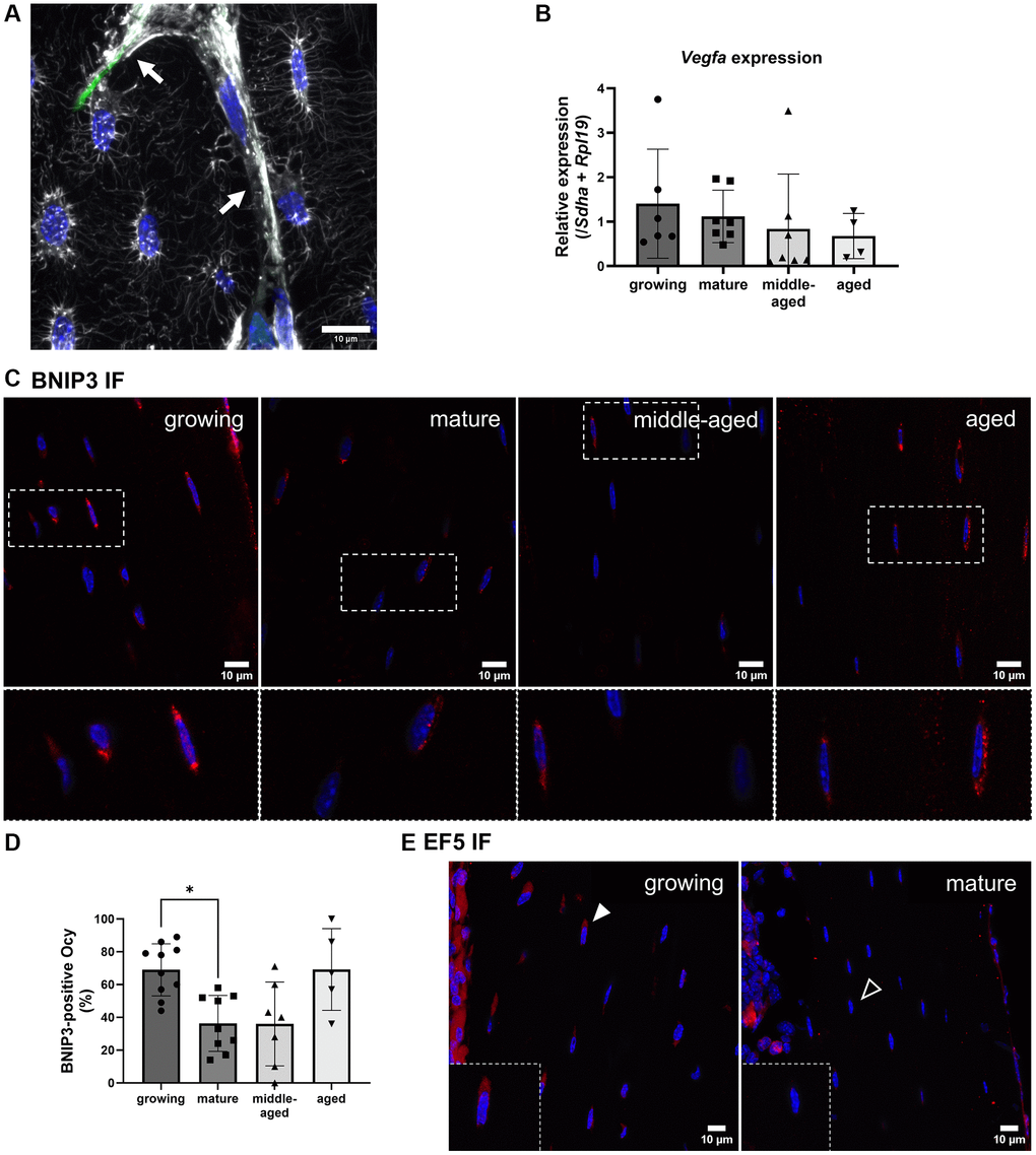 Hypoxia detection and VEGFA expression in osteocytes. (A) Phalloidin labeling in a growing animal showing numerous connections between osteocyte dendrites (white) and blood vessels (arrows). (B) Vegfa gene expression. (C) Representative images for BNIP3 immunofluorescence for the 4 groups, BNIP3 labeling appears in red, nuclei appear in blue. (D) Quantification of BNIP3-positive osteocytes (Ocy) based on immunofluorescence (IF). (E) Representative images for EF5 detection for the growing and mature groups, positive cells appear in red (filled arrowhead), the empty arrowhead shows a negative cell, nuclei appear in blue. The data are presented as mean ± s.d. Statistical analyses: KW, Dunn’s multiple comparison test with the mature group as reference, *p 