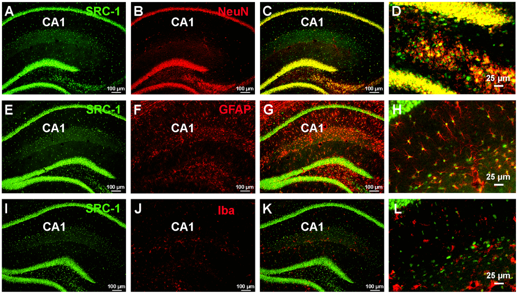The expression of SRC-1 in the hippocampus. (A–C) Co-staining of SRC-1 (green, A) and a neuron marker (NeuN, red, B), and merge (C) in the hippocampal CA1 region. (D) is high magnification indicating co-expression of SRC-1 in NeuN labeled neurons. (E–G) Co-staining of SRC-1 (green, E) and an astrocyte marker (GFAP, red, F), and merge (G) in the hippocampal CA1 region. (H) is high magnification indicating co-expression of SRC-1 in GFAP labeled astrocytes. (I–K) Co-staining of SRC-1 (green, I) and a microglial marker (Iba, red, J), and merge (K) in the hippocampal CA1 region. (L) is high magnification indicating no double-labelling.