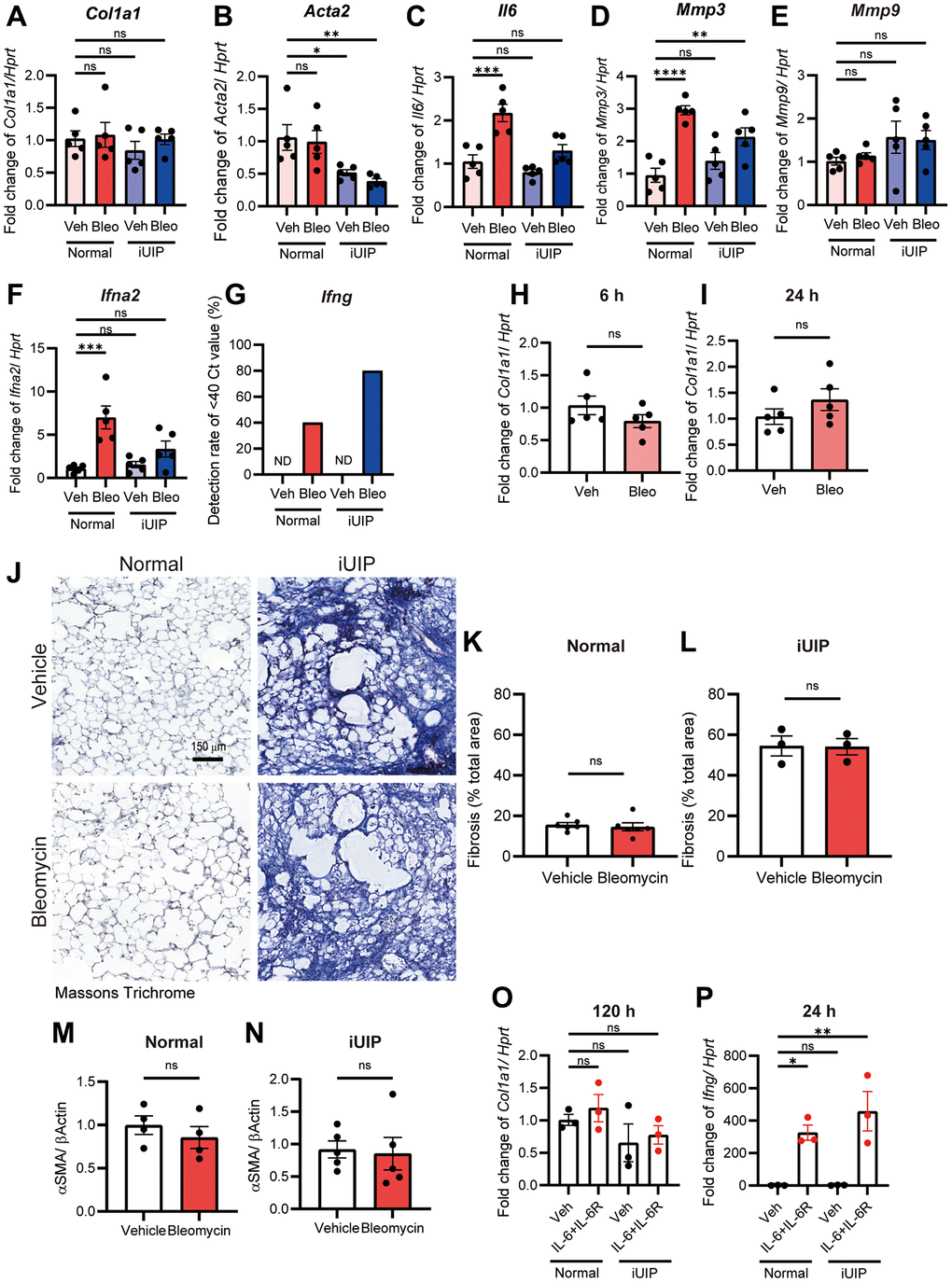 Bleomycin treatment did not directly induce fibrosis in normal and iUIP PCLS. (A–G) Normal and iUIP PCLS samples were treated with the vehicle or 1 μM bleomycin for 120 h. The expression levels of Col1a1 (A), Acta2 (B), Il6 (C), Mmp3 (D), Mmp9 (E), Ifna2 (F), and Ifng (G) were determined using qPCR. Ifng expression was not detected in vehicle-treated normal and iUIP PCLS. The detection rates of samples with Ct values G). (H, I) PCLS samples were treated with the vehicle or 1 μM bleomycin for 6 (H) and 24 h (I). The expression of Col1a1 was determined using qPCR. (J) Masson’s trichrome staining of PCLS from normal and iUIP treated with the vehicle or 1 μM bleomycin for 48 h. (K–N) Percentage of fibrosis area ratio (K, L) were calculated based on the total area in each PCLS. (M, N) aSMA expression was determined using WB in PCLS from normal and iUIP treated with the vehicle or 1 μM bleomycin for 48 h. β-Actin was used as an internal control for WB. (O, P) PCLS samples were treated with vehicle or IL-6 (50 ng/mL) and IL-6R (50 ng/mL) for 120 (O) and 24 h (P). The expression of Col1a1 (O) and Ifng (P) was determined using qPCR. Hprt served as an internal control. The results are shown as mean ± SE of n = 5 mouse PCLSs at each stage (n = 3 mouse PCLS for iUIP fibrosis and n = 4 of normal in aSMA WB (M)). Asterisks indicate *P **P ***P ****P 