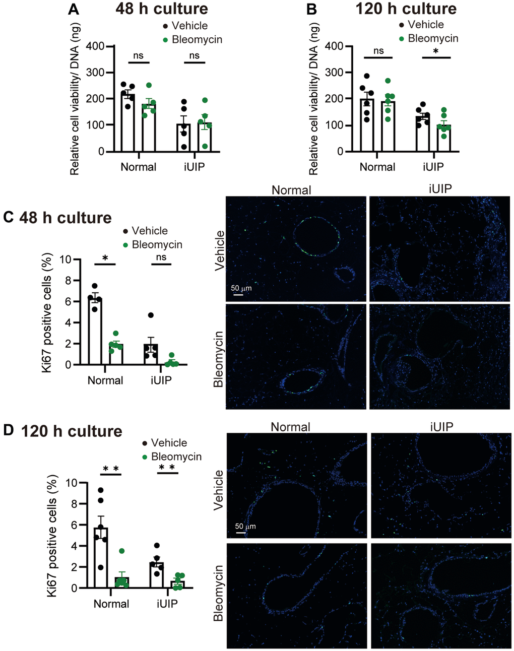 Viability was reduced after bleomycin treatment in PCLS from iUIP mice. (A, B) Relative viability was examined in PCLS from normal and iUIP treated with the vehicle or 1 μΜ bleomycin for 48 (A) or 120 h (B). Values were normalized to DNA content. (C, D) Ki67-positive cells in paraffin-embedded sections were stained and calculated based on the total number of cells. The results are shown as mean ± SE of five mouse PCLSs at each stage. Asterisks indicate *P **P 