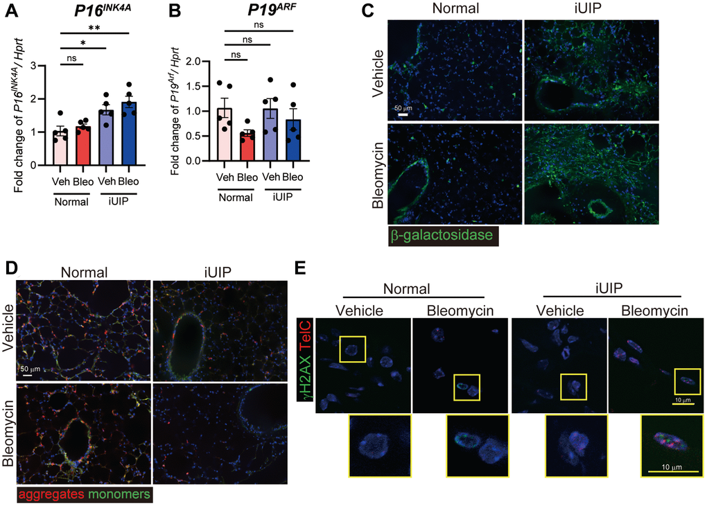Excessive senescence occurred in iUIP PCLS treated with bleomycin. (A, B) PCLS samples were treated with the vehicle or 1 μM bleomycin for 120 h. P16INK4A (A) and P19ARF (B) expression were determined using qPCR. Hprt was used as an internal control for qPCR. The results are shown as mean ± SE of five mouse PCLSs at each stage. Asterisks indicate *P **P C) β-galactosidase staining was detected in PCLS from normal and iUIP was treated with the vehicle or 1 μΜ bleomycin for 48 h. (D) JC-1 staining was detected in PCLS from normal and iUIP was treated with the vehicle or 1 μΜ bleomycin for 4 h. (E) TAFs (TelC, red) were co-localized with γH2AX (green) using IF and telomere in situ hybridization. Scale bars indicate 50 μm (white) and 10 μm (yellow).