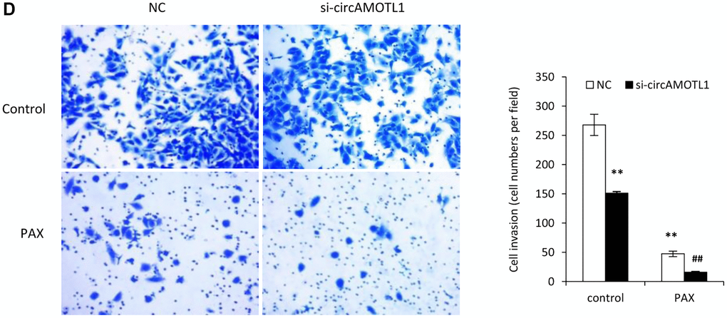 Effect of circAMOTL1 siRNA on PAX treatment. MDA-MB-231 cells transfected with negative control or circAMOTL1 siRNA (si-circAMOTL1) were treated with 1 μg/ml PAX for 24 hours. … ((D) Cell invasive ability upon PAX treatment was measured with Matrigel invasion assay. Experiments were performed in triplicate. **p ##p 
