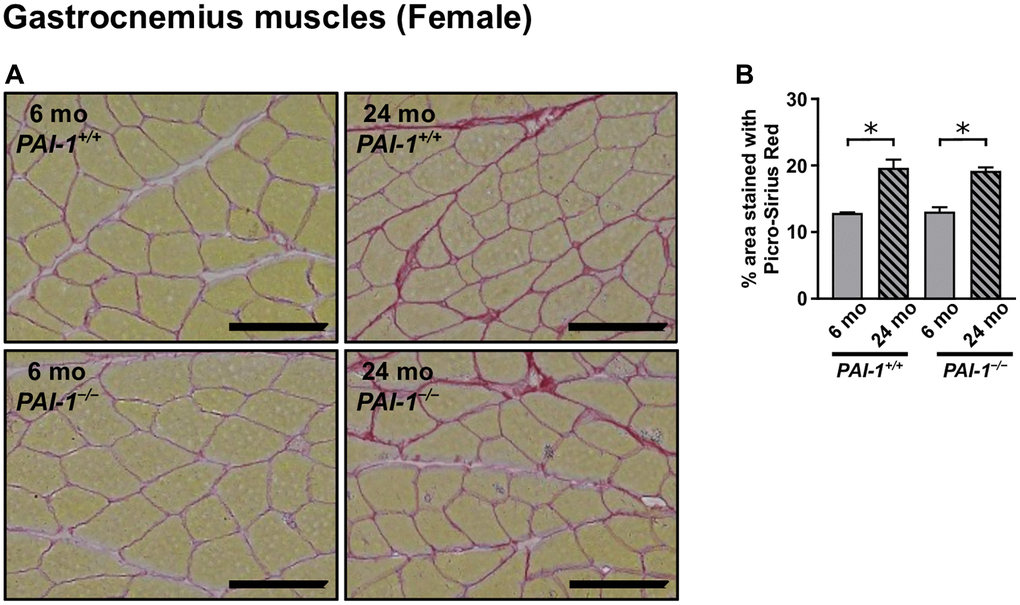 Aging-related tissue fibrosis in the gastrocnemius muscles of female mice. Picro-Sirius Red-stained cross-sections of the gastrocnemius muscles from 6- and 24-month-old female mice with PAI-1 gene deficiency (PAI-1−/−) and their wild-type counterparts (PAI-1+/+) are shown (A). Photomicrographs of four regions in each muscle section were analyzed, and the mean occupancy of collagen-containing fibrotic areas in tissue sections was calculated (B) (n = 3 in each group). Scale bars = 100 μm. Data are presented as mean ± standard error of the mean. *P 