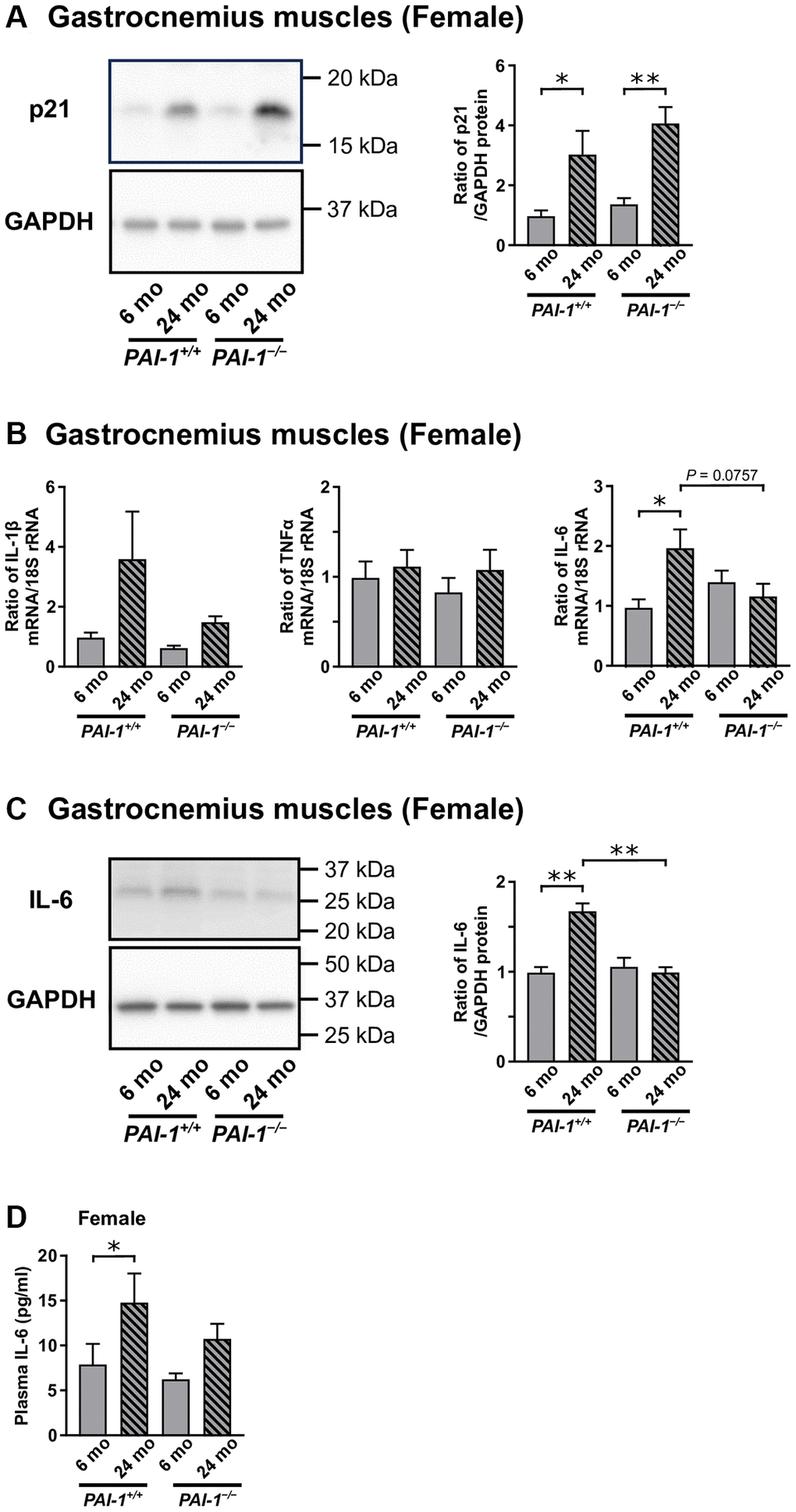 Aging-related changes in the gene or protein expression levels of cellular senescence and senescence-associated secretory phenotype (SASP) markers in the gastrocnemius muscles of female mice. The protein expression levels of the cellular senescence marker, p21, in the gastrocnemius muscles of 6- and 24-month-old female mice with PAI-1 gene deficiency (PAI-1−/−) and their wild-type counterparts (PAI-1+/+) are shown (A) (n = 8−10 in each group). Results of Western blot analysis for p21 are expressed as a ratio to GAPDH. Moreover, the gene expression levels of the SASP markers (B), IL-1β, TNFα, and IL-6, in the gastrocnemius muscles of 6- and 24-month-old female PAI-1+/+ and PAI-1−/− mice are shown (n = 9−10 in each group). Results of real-time PCR analyses for IL-1β, TNFα, and IL-6 mRNA are expressed as a ratio to 18S rRNA. The protein expression levels of IL-6, expressed as a ratio to GAPDH, in the gastrocnemius muscles of 6- and 24-month-old PAI-1+/+ and PAI-1−/− female mice are shown (C) (n = 4 in each group). Plasma IL-6 levels in 6- and 24-month-old PAI-1+/+ and PAI-1−/− female mice are shown (D) (n = 9−10 in each group). Data are presented as mean ± standard error of the mean. *P 