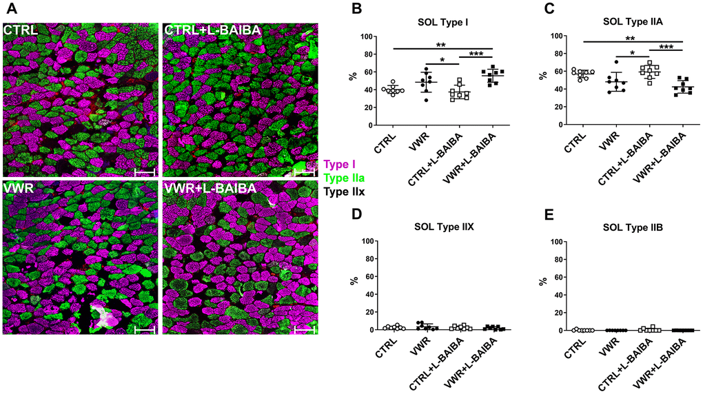 Soleus muscle fiber type analysis after the three-month intervention period. (A) Representative images of soleus (SOL) muscle histological sections stained for type I (pink), type IIA (green), type IIX (no staining), or type IIB (red) myosin heavy chain. The scale bars represent 100 μm. Quantitation of the percentage of type I (B), type IIA (C), type IIX (D), or type IIB (E) myofibers. ***ppp