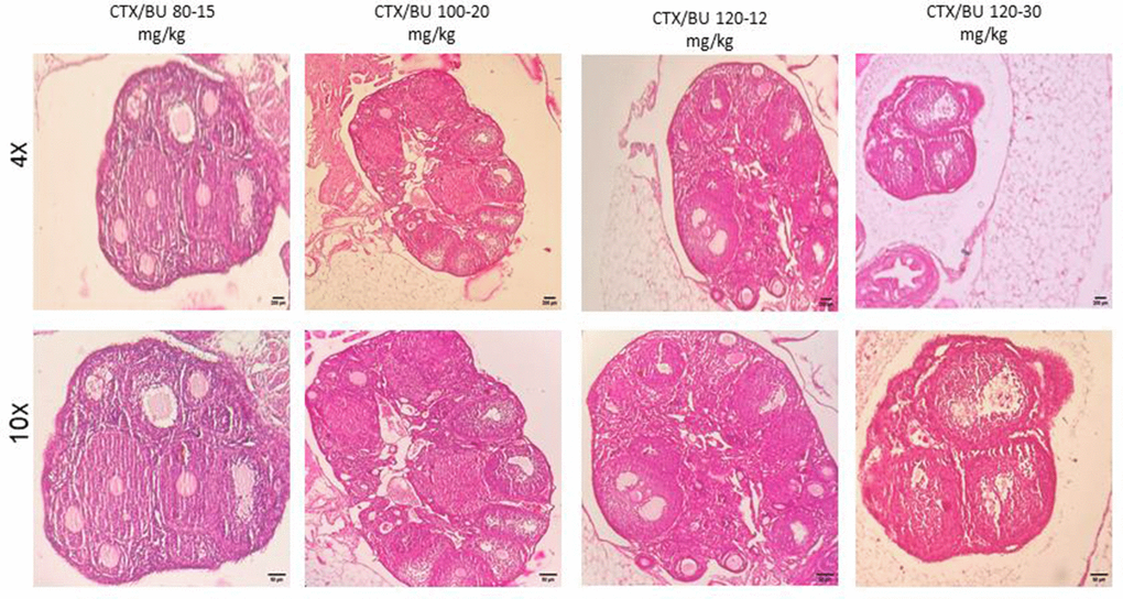 POF in NMRI female 6-8 weeks mice. Dose-response of ovarian follicles destruction by Cyclophosphamide (CTX: 80, 100, 120mg/Kg) and Busulfan (Bu: 15,20,12,30mg/Kg) for 3 weeks, observed at different magnifications (4× = 40×, 10× = 100×).