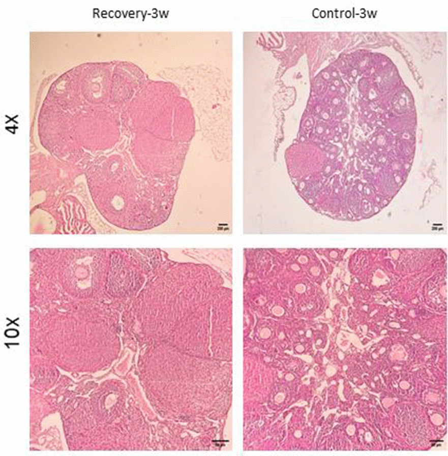 Confirmation of natural recovery after 3 weeks of establishment POF model in NMRI female 6-8weeks mice. Histological confirmation of ovarian POF phenotype three weeks after induction with CTX (100 mg/kg) + Bu (20 mg/kg), showing reduced primordial follicle reserve, increased atretic follicles, and widespread granulosa cell apoptosis.