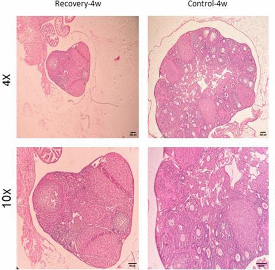 Confirmation of natural recovery after 4 weeks of establishment POF model in NMRI female 6-8weeks mice. Histological confirmation of POF phenotype at four weeks post-induction with CTX (100 mg/kg) + Bu (20 mg/kg). Findings demonstrate persistent follicular depletion and stromal atrophy with no signs of natural follicular recovery.