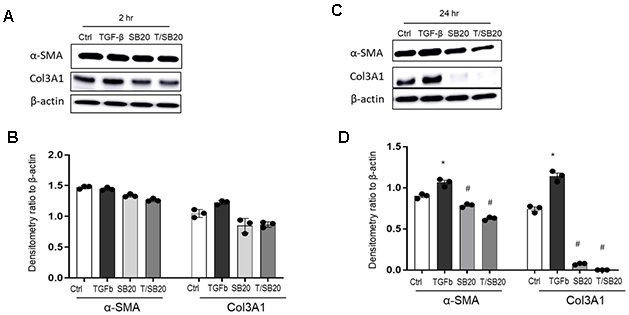 α-SMA and Col3A1 protein expression in response to TGF-β1 with or without p38 MAPK inhibitor SB202190. IMR90 cells were subjected to p38 MAPK inhibitor alone or, treated with TGF-β1 (2ng/ml) at 2h (A, B) or 24h (C, D) for densitometry with or without pretreatment for 2h of SB202190 (10μM). β-actin was used as a loading control. T indicates TGF-β1; SB20, SB202190. Results are average of at least three independent experiments. Bar graphs indicate mean ± standard errors (SE). * p