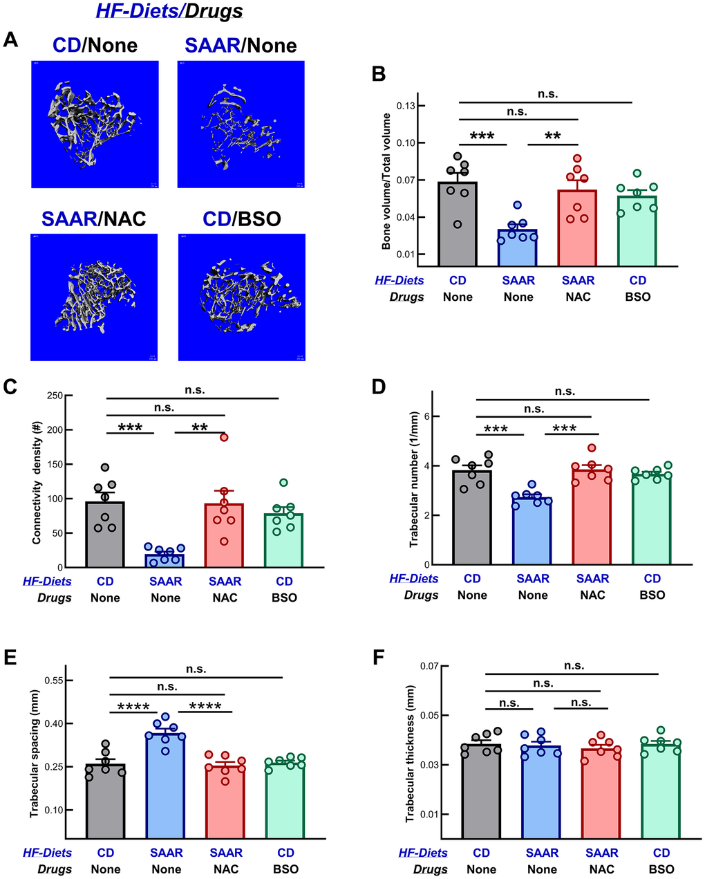 Unlike the SAAR diet, BSO does not decrease trabecular bone mineral density. (A) Representative images of the micro-CT scanning of trabecular bone in tibiae show that the SAAR diet lowered multiple measures of trabecular bone density, including (B) the ratio of bone volume to total volume (SAAR C) connectivity density (SAAR D) trabecular number (SAAR E) trabecular space (SAAR > CD) but did not affect (F) trabecular thickness (SAAR = CD). As we hypothesized, NAC reversed all the SAAR-induced changes to the levels observed in the CD group, while BSO did not affect any of these parameters (SAAR  [NAC = CD] in figure E). Note: One-way ANOVA followed by Tukey’s multiple comparison tests was used to find group-wise differences (*P ≤ 0.05, **P ≤ 0.01, ***P ≤ 0.001, ****P ≤ 0.0001; bars and error bars represent means and standard errors of the mean; n = 7/group).