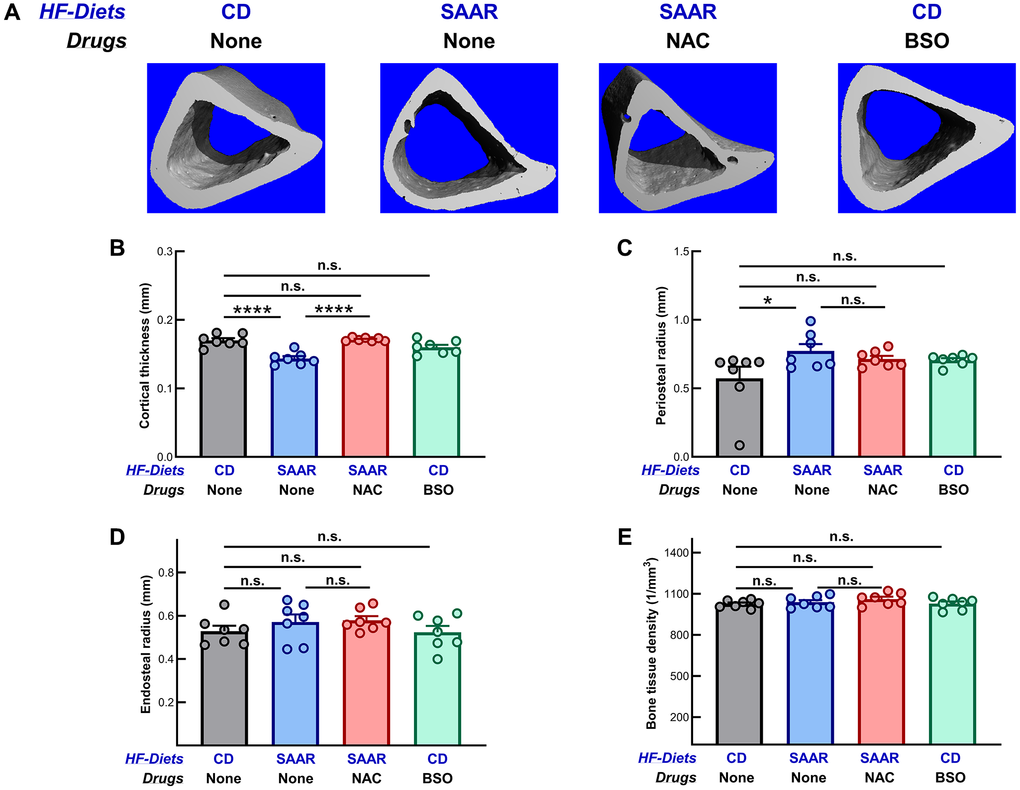Unlike the SAAR diet, BSO does not decrease cortical bone mineral density. Images of cortical cross-sections are shown in (A). Similar to its effect on the trabecular bone, the SAAR diet (B) decreased cortical thickness (SAAR C) increased periosteal radius (SAAR > CD), indicating a decrease in cortical bone density. However, the SAAR diet did not affect (D) endosteal radius (SAAR = CD) and (E) bone tissue density (SAAR = CD). NAC, as expected, reversed the decrease in cortical thickness (SAAR Figure 1.