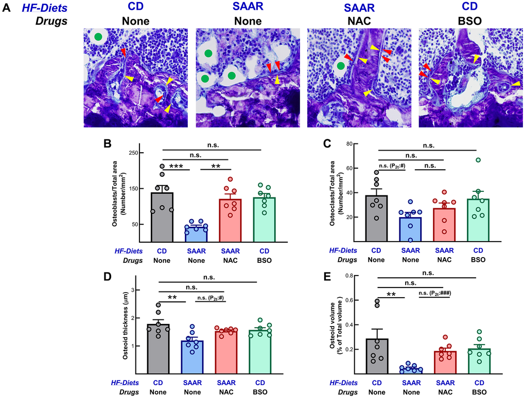 The SAAR diet and BSO exert opposing effects on osteoblast number. Photomicrographs of the proximal tibia (40X magnification) showing osteoblasts on bone surfaces (red arrowheads), osteoid (yellow arrowheads), and bone marrow adipocytes (green circles in the adipocytes) are shown in (A). Consistent with the changes in bone mineral density, the SAAR diet decreased the number of (B) osteoblasts (SAAR C) osteoclasts (SAAR D) osteoid thickness and (E) osteoid volume; NAC reversed both. BSO did not affect any of these measures. Note: Sample sizes and statistical methods are similar to those in Figure 1.
