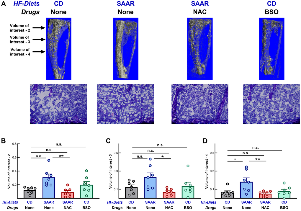 The SAAR diet, but not BSO, increases marrow adipocytes in tibiae. Micro-CT (first row) and photomicrographs (second row) of osmium-stained images of tibiae are shown in (A). Compared with the CD, the SAAR diet increased marrow adipocytes at volumes of interest 2 and 4, but not at volume of interest 3 (B–D, SAAR > CD). NAC reversed the increase in SAAR at all volumes of interest (B–D, SAAR > [CD = NAC]), while BSO had no effect (CD = BSO). Sample sizes and statistical methods are similar to those in Figure 1. Note: Volume of interest-1 is not shown in the figure.