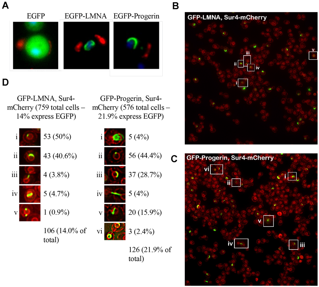 EGFP-LMNA and EGFP-Progerin localize to the yeast nuclear membrane. (A) Aliquots of cells from each EGFP (left panel), EGFP-LMNA (middle panel) and EGFP-Progerin (right panel) were fixed and prepared for fluorescence microscopy. Green signal indicates EGFP signal. Cells were labelled with wheat germ agglutinin (red) to mark bud scars on the cell periphery. Chromatin is counterstained with Hoechst 33342 dye to mark nuclei (blue). (B) and (C) Live cell imaging of fluorescence tags was performed in a yeast strain containing an endogenous SUR4-mCherry epitope to fluorescently mark the nuclear membrane (red). The SUR4-mCherry cells were transformed with EGFP-LMNA (B) or EGFP-Progerin (C), grown overnight in Ura- media supplemented with 2% Raf for 24h, diluted to an OD600 of 0.2 in fresh Ura- media supplemented with 2% galactose, then incubated at 30° C for 6 hours. (D) Examples of cells highlighted in (B) and (C) were shown in the inset regions, and counted. The percent of total cells expressing EGFP with different localization patterns is given.