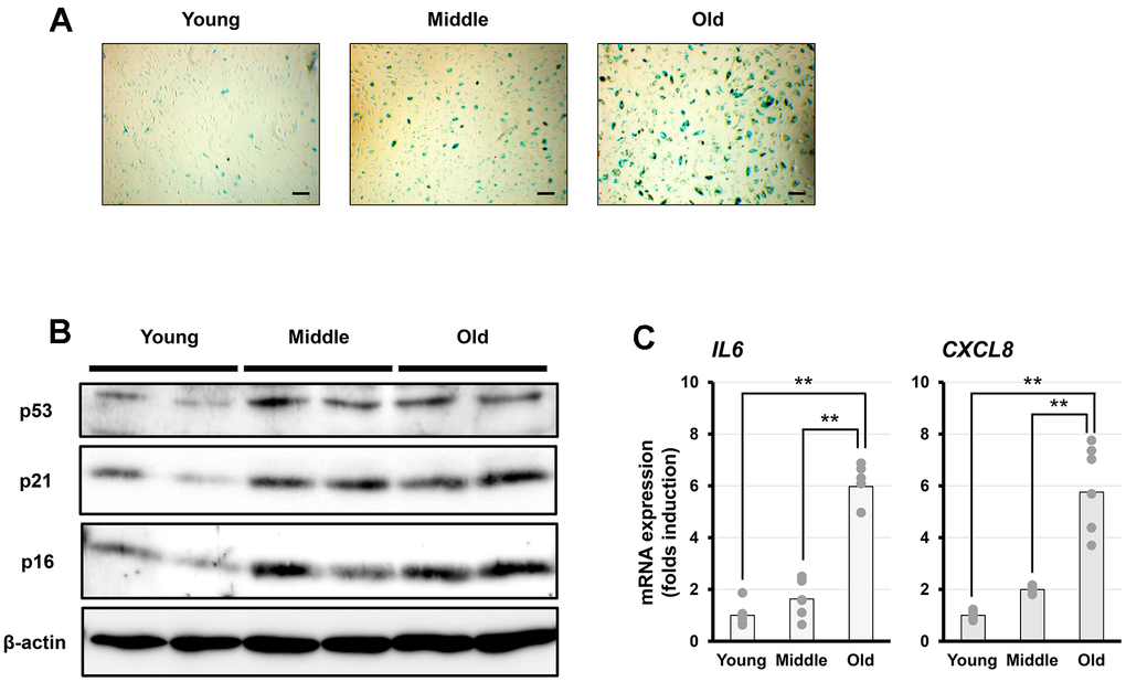 Characterization of senescent cells in vitro. (A) Representative images of senescence-associated β-galactosidase (SA-β-gal) staining in fibroblasts at different senescent stages (young, middle, and old). Scale bar = 200 μm. (B) Representative western blot analysis of p53, p21, and p16, with β-actin as a loading control. (C) PCR analysis of interleukin-6 (IL-6) and interleukin-8 (IL-8) expression. Data are presented as the mean ± standard error (SE) from seven independent experiments (n = 7). Statistical analysis was performed using the Tukey–Kramer test; **p 