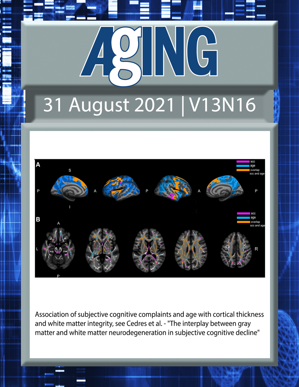 The cover features Figure 1 " Association of subjective cognitive complaints and age with cortical thickness and white matter integrity“ from Cedres et al.