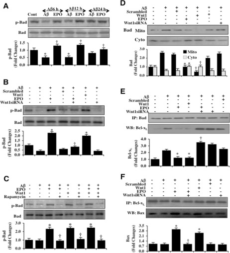 EPO through Wnt1 phosphorylates Bad, controls mitochondrial trafficking of Bad, and modulates Bad, Bcl-xL, and Bax binding