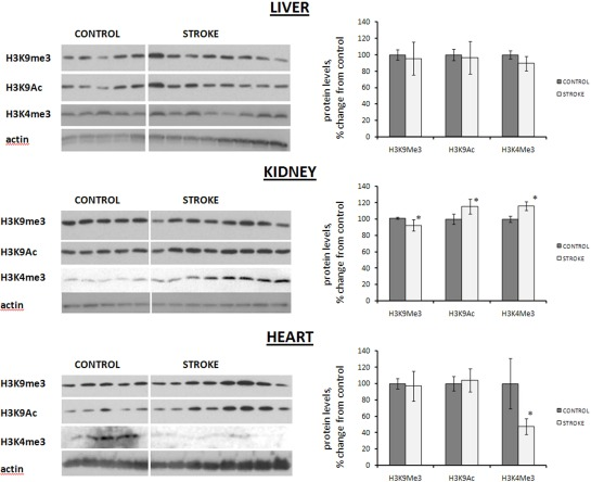 Histone modification levels in liver, heart and kidney tissues of control and stroked rats