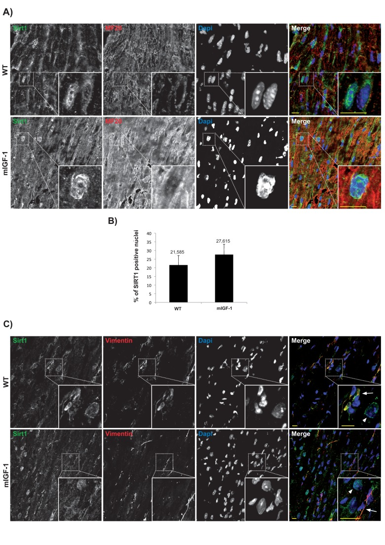 Confocal analysis of SIRT1 localization in the heart of wild type and mIGF-1 transgenic mice