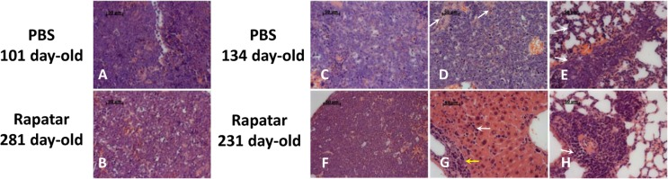 Rapatar delays development of lymphomas in p53−/− mice. (A) Representative initial lymphoma developed in control mouse at the age of 101 days. (B) Similar appearance of lymphoma in Rapatar-treated mouse at 281 days of age. Both A and B show monotonous infiltrate of medium-sized neoplastic cells with round nuclei, fine chromatin, indistinct nucleoli, and numerous mitotic figures and apoptotic cells. (C) Advanced lymphoma in 134-day old control mouse with metastases in liver (D) and lung (E). (D) Metastasis in liver showing the extensive spread of neoplastic cells effaces the normal structure and only minimal remnants of hepatocytes (marked by arrows). (E) Metastasis in the lung showing neoplastic infiltrates in perivascular area and in the alveolar walls (arrows) (F) Advanced lymphoma with pathological changes similar to shown in C in the thymus of 241day-old Rapatar-treated animal with metastasis in liver (G) and lung (H). (G) Metastasis in liver showing neoplastic infiltrates in portal tract (yellow arrow) and sinusoids (white arrow). (H) Metastasis in the lung showing perivascular neoplastic infiltrate (arrow).
