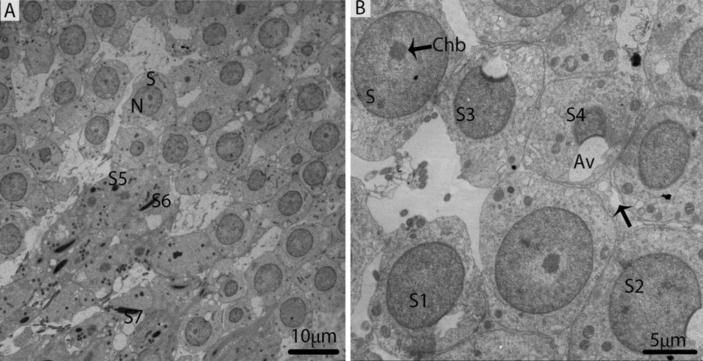 Electron micrograph of seminiferous tubules in October. (A) The majority of cell types within the seminiferous tubules are round/elongated spermatids. (B) Different stages of spermiogenic cells. S: spermatid; eS: elongated spermatid; SC: Sertoli cell; Sp: spermatid; Av: acrosomal vesicle; Chb: chromatin body; (arrow). Scale bar= 10μm (A) and 5μm (B).