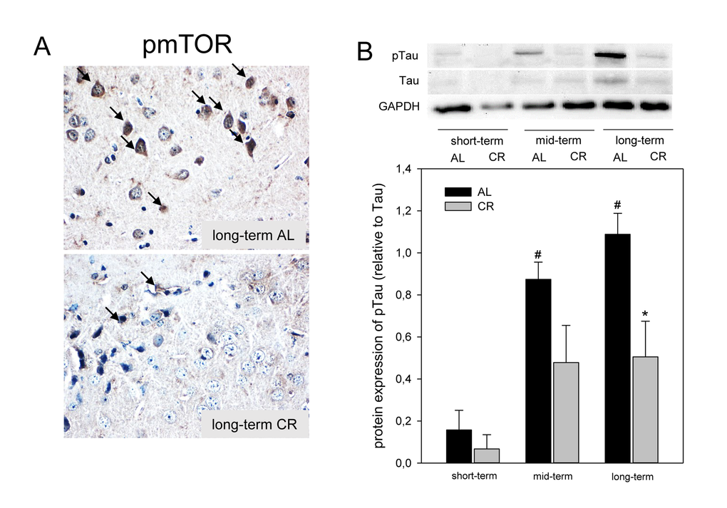 (A) Representative immunohistochemical images (original magnification x400) of pmTOR expression in brain of long-term ad libitum- (AL, upper panel) and of caloric-restricted-fed (CR, lower panel) ApoE-/- mice. (B) Representative Western blot and densitometric analysis of pTau in brain of ApoE-/- mice. Mice were fed either AL or CR (60% of ad libitum) for a short-term (4 weeks; n=14), mid-term (20 weeks; n=14) or long-term (64 weeks; n=14). Signals were corrected to Tau. GAPDH served as loading control. Values are given as means ± SEM; ANOVA, post-hoc pairwise comparison tests: * p 