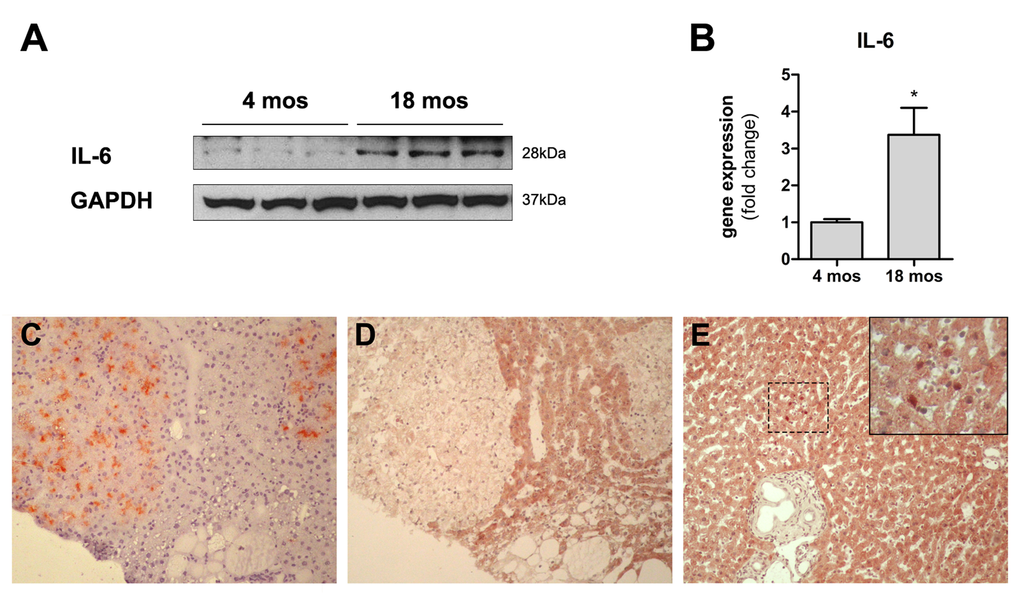 Panels (A) and (B) Expression of IL6 in the liver of animals transplanted with pre-neoplastic hepatocytes in at young or old age and killed 3 months after Tx. Both the protein (panel A) and the corresponding mRNA (panel B) were expressed at higher levels in the liver of aged animals. Panels (C) and (D) serial sections showing histochemical staining for DPPIV+ (panel C) and immuno-histochemical staining for STAT3 (panel D) in clusters of transplanted nodular hepatocytes. Only rare STAT3+ nuclei were detected in the aged rat liver (panel E). 100x magnification.