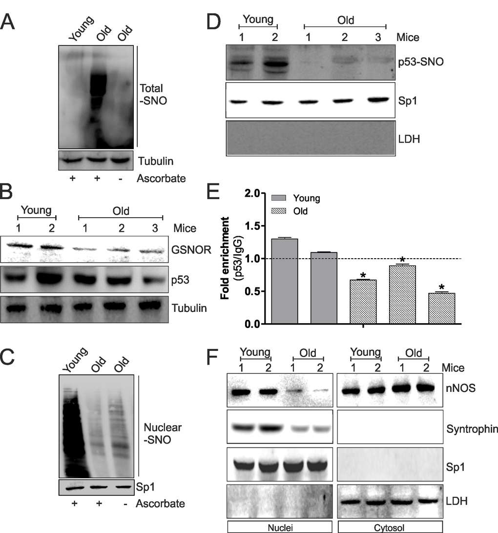 The decrement of nNOS nuclear localization inhibits p53 S-nitrosylation and its binding on ppargc1a promoter during aging. (A) Skeletal muscle of young (12 weeks) and old (80 weeks) mice was homogenized and total proteins (500 μg) were subjected to S-NO derivatization with biotin. After Western blot, biotin adducts were identified by incubating nitrocellulose membrane with HRP-conjugate streptavidin. Proteins incubated in labeling buffer without ascorbate were used as negative control (-Ascorbate). Tubulin was used as loading control. (B) Skeletal muscle of two young (12 weeks) and three old (80 weeks) mice was homogenized and total proteins (20 μg) were loaded for Western blot analysis of GSNOR and p53. Tubulin was used as loading control. (C) Skeletal muscle of young (12 weeks) and old (80 weeks) mice was homogenized and nuclear proteins (500 μg) were subjected to S-NO derivatization with biotin. After Western blot, biotin adducts were identified by incubating nitrocellulose membrane with HRP-conjugate streptavidin. Proteins incubated in labeling buffer without ascorbate were used as negative control (-Ascorbate). Sp1 was used as loading control. (D) Skeletal muscle of two young (12 weeks) and three old (80 weeks) mice was homogenized and nuclear proteins (500 μg) were subjected to S-NO derivatization with biotin. After Western blot the nitrocellulose was incubated with p53 antibody for detection of p53-SNO. Sp1 was used as loading control. The possible presence of cytoplasmic contaminants was tested by incubating nitrocellulose with rabbit anti-LDH. (E) ChIP assay was carried out on cross-linked nuclei from two young (12 weeks) and three old (80 weeks) mice using p53 antibody followed by qPCR analysis of p53RE. Dashed line indicates the value of IgG control. Data are expressed as means ± S.D. (n=3; *pF) Skeletal muscle of two young (12 weeks) and two old (80 weeks) mice was homogenized and 20 μg of nuclear and cytoplasmic extracts were loaded for detection of nNOS and Syntrophin by Western blot. Sp1 was used as loading control. The possible presence of cytoplasmic contaminants was tested by incubating nitrocellulose with rabbit anti-LDH. All the immunoblots reported are from one experiment representative of four that gave similar results.