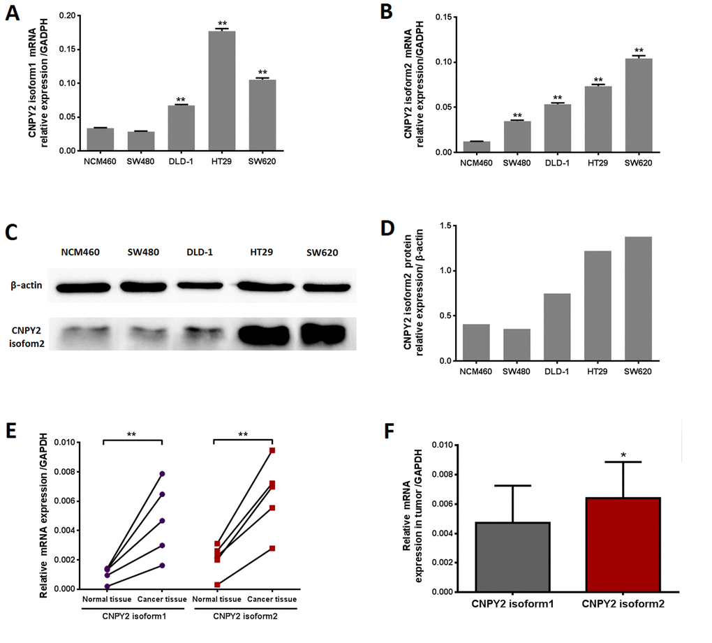 CNPY2 mRNA expression evaluated by RT-PCR. (A) CNPY2 isoform1 mRNA was signiﬁcantly higher in CRC cell lines (DLD-1, SW620, and HT29) than normal colonic epithelial cells (NCM460) **, P B) CNPY2 isoform2 mRNA was signiﬁcantly increased in all CRC cell lines (SW480, DLD-1, SW620, and HT29) compared to that in NCM460 cells, **, P C) Protein expression of CNPY2 isoform2 in CRC cell lines (SW480, DLD-1, SW620, and HT29) and NCM460 cells determined by western blot. (D) The relative expression of CNPY2 isoform2 in NCM460, SW480, DLD-1, SW620, and HT29 was 0.41, 0.36, 0.75, 1.22 and 1.38, respectively. (E) Expression of the two CNPY2 isoforms was signiﬁcantly higher in tumor tissues than in tumor-adjacent normal tissues (n = 5, **, P F) Expression of CNPY2 isoform2 was significantly higher compared to that of CNPY2 isoform1 in tumor tissues (n = 5, *, P 