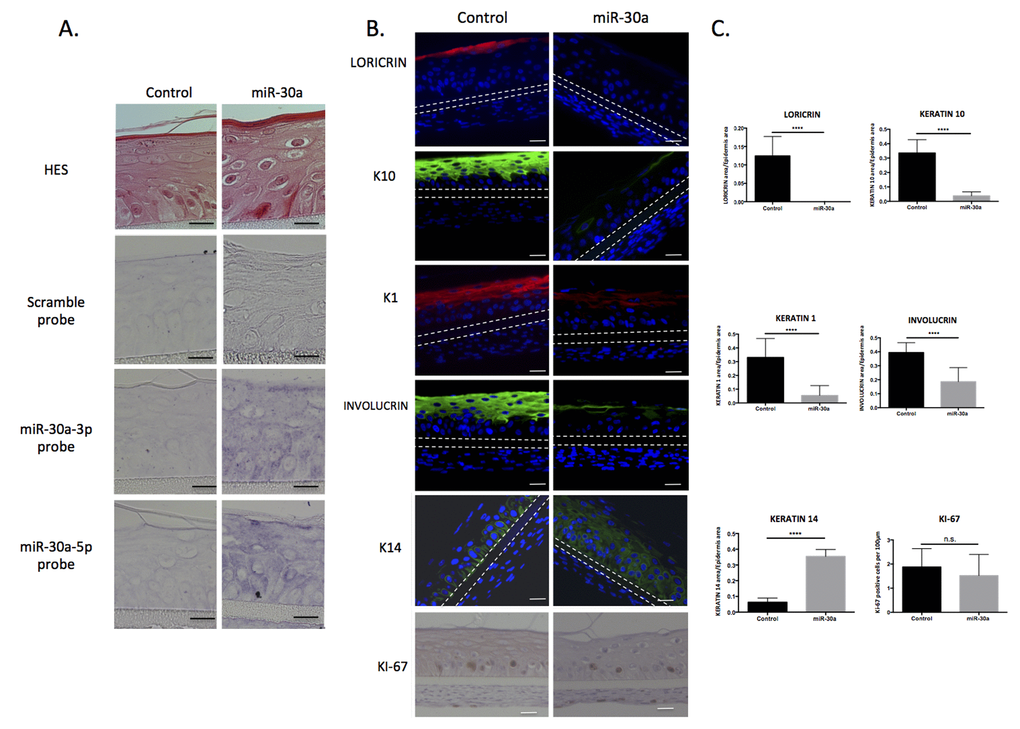 Caracterization of reconstructed epidermis overexpressing miR-30a. Reconstructed epidermis (REs) were generated from keratinocytes transduced with the miR-30a lentiviral construction and treated by doxycycline to activate miR-30a expression. (A) Evaluation of the morphology of the REs by HES staining and confirmation of the miR-30a overexpression by in situ hybridization in control and miR-30a RE. (B) Immunofluorescent staining of differentiation markers (LORICRIN, K10, K1, INVOLUCRIN and K14) and immunohistochemical staining of proliferation marker (Ki67) in control and miR-30a overexpressing REs. Counterstaining was performed with DAPI and the polycarbonate membrane is indicated by dotted lines. (C) Quantification of the LORICRIN, K10, K1, INVOLUCRIN and K14 labeled area in the REs and evaluation of the number of KI67-positive cells. Results are mean +/- SD from three independent samples. ****P