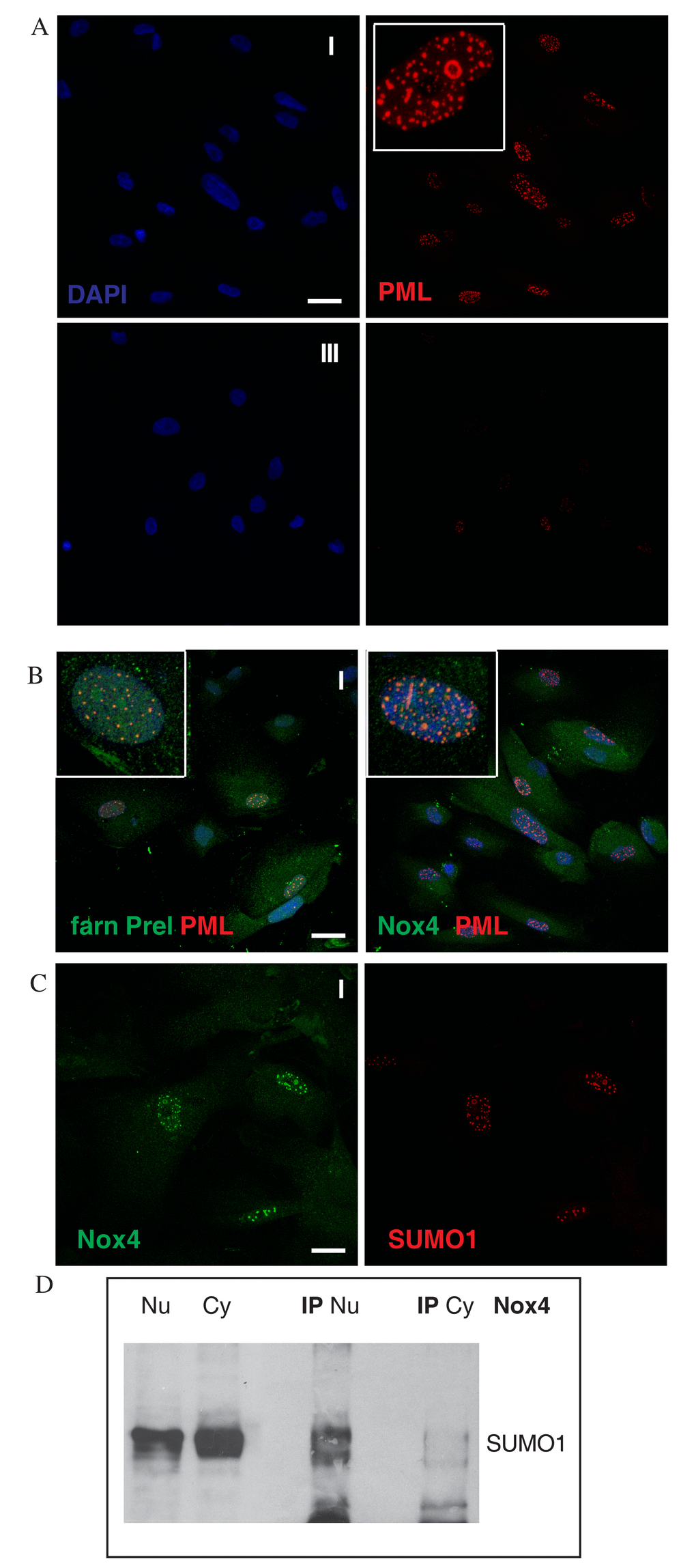 Nox4 post-translational modification in nuclei of AFSC. (A) Representative images showing DAPI (blue) and PML (red) of AFSC of group I and III. Tripled magnification image is present in white square of group I. (B) Representative images of AFSC group I (faster senescent cells) showing superimposing of DAPI (blue), farnesylated prelamin A (green) or Nox-4 (green) and PML (red). Tripled magnification image is present in white square of both. Scale bar= 10 µm. (C) Representative confocal image of AFSC group I samples labelled with Nox4 (green) and SUMO1 (red). Scale bar= 10 µM. (D) Western blot analysis of nuclear lysate (Nu), cytoplasmic lysate (Cy) and immunoprecipitation experiment of Nu and Cy with Nox4 antibody then revealed with anti-SUMO1. Data are representative of three independent experiments.