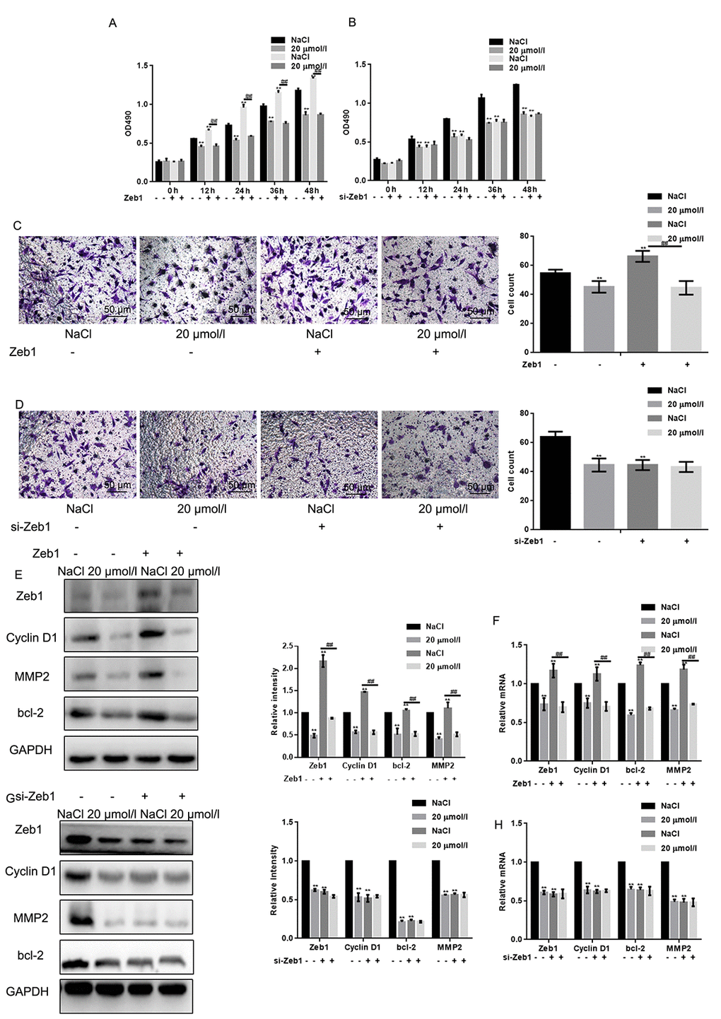 Naringin suppresses osteosarcoma cell proliferation and migration by inhibiting Zeb1. (A) MTT proliferation assay of MG63 cells expressing a control vector or Zeb1. Cells were incubated with 20 μmol/L of naringin or NaCl and assayed at the indicated times. Results represent the mean ± SD of three experiments done in triplicate. **P P B) MTT proliferation assay of MG63 cells transfected with si-Zeb1 (Zeb1 silencing) or si-NC (negative control). Cells were treated with 20 μmol/L of naringin or NaCl and assayed at the indicated times. Results represent the mean ± SD of three experiments done in triplicate. **P C) Results of Transwell migration assays (without Matrigel) performed in MG63 cells expressing control vectors or Zeb1. Cells were treated with 20 μmol/l of naringin or NaCl. **P P D) Results of Transwell migration assays (without Matrigel) performed in MG63 cells transfected with si-Zeb1 (Zeb1 silencing) or si-NC (negative control). Cells were treated with 20 μmol/l of naringin or NaCl. **P E, F) Western blot and real-time PCR assay results for Zeb1, Cyclin D1, bcl-2, and MMP2 expression in MG63 cells expressing Zeb1 or empty vector. Cells were incubated with 20 μmol/l of naringin or NaCl (control). **P P G, H) Western blot and real-time PCR assay results for Zeb1, Cyclin D1, bcl-2, and MMP2 expression in MG63 cells transfected with si-Zeb1 or si-NC. Cells were treated with 20 μmol/l of naringin or NaCl. **P 