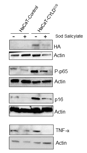 The reduction of the NF-κB overactivation in keratinocytes expressing the CYLDC/S mutant decreases the expression of the biomarker of aging p16 and TNFα. HaCaT (Control and CYLDC/S) cells were treated with sodium salicylate for 48h when indicated (+). WB shows that HaCaT-CYLDC/S cells exhibit increased levels of expression of P-p65, p16 and TNFα, but the treatment with sodium salicylate, which reduced P-p65 levels, also decreases p16 and TNF-α levels in these cells. Actin was used as a control loading.