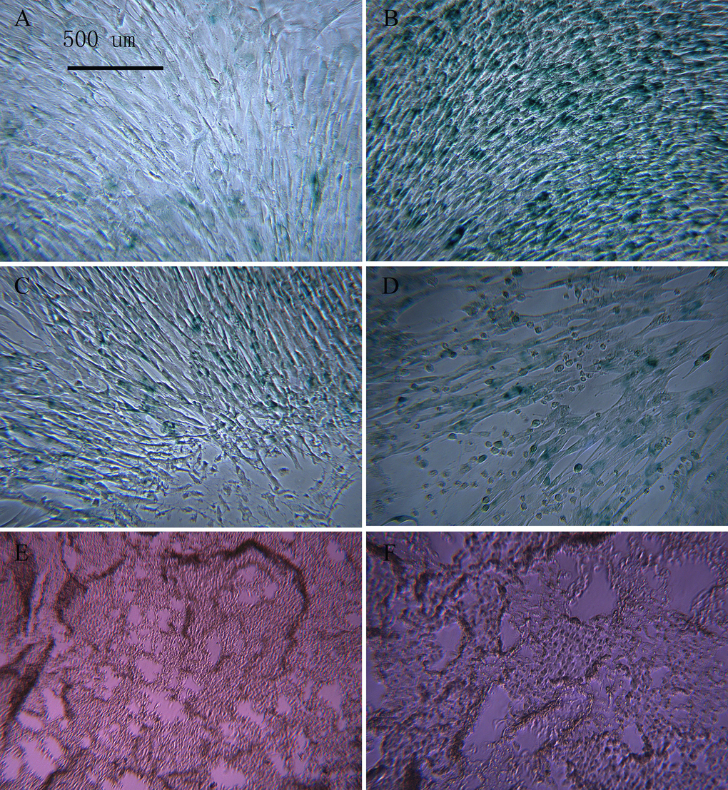BMSCs treated with different concentrations of t-BHP and stained with SA-β-gal (×100)