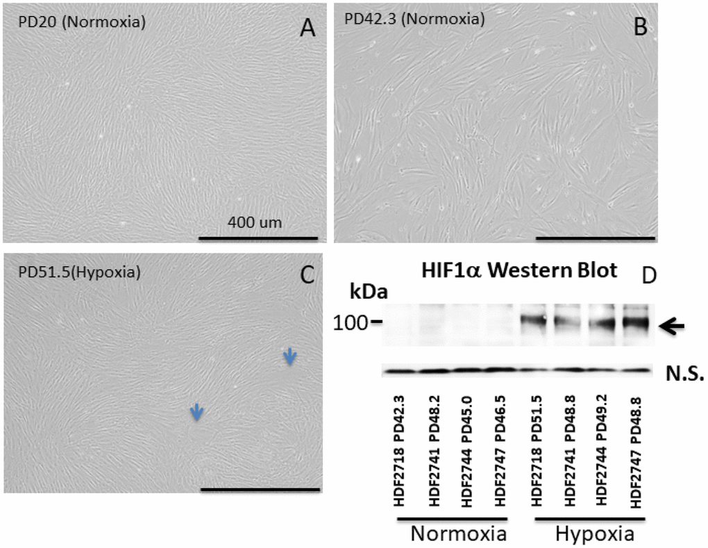 Images of neonate human dermal fibroblasts (HDFs) (A–C) and Western blot of HIF1α (D). (A–C) HDFs cultured in normoxia and hypoxia. All images were taken at the same magnification. Each 4-digit number in the graph (#2718, #2741, #2744, and # 2747) indicates the batch of the cell line from the vendor (Cell Applications, San Diego, CA). Bar: 400 μm. (A) HDFs at population doubling (PD) number 20 in normoxia, (B) HDFs at PD 42.3 in normoxia, (C) HDFs at PD 51.5 in hypoxia. Cells cultured in hypoxia maintained a small cell size in comparison with cells in normoxia. (D) Western blot of HIF1α. HIF1α was stabilized in all 4 cell lines cultured under hypoxia.