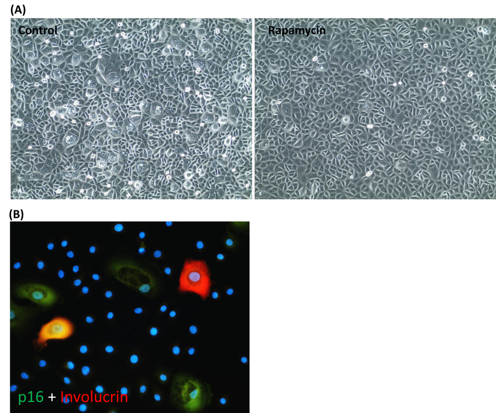 Rapamycin suppresses the emergence of senescent cells and spontaneous keratinocyte differentiation. (A) Phase contrast picture of primary keratinocytes cultured in CnT-07 medium in the absence (left panel) or presence (right panel) of rapamycin. (B) The large keratinocytes seen in (A) were stained positive with antibodies against p16 (in green), involucrin (red) or both, p16 and involucrin (yellow). Nuclei were stained with DAPI.