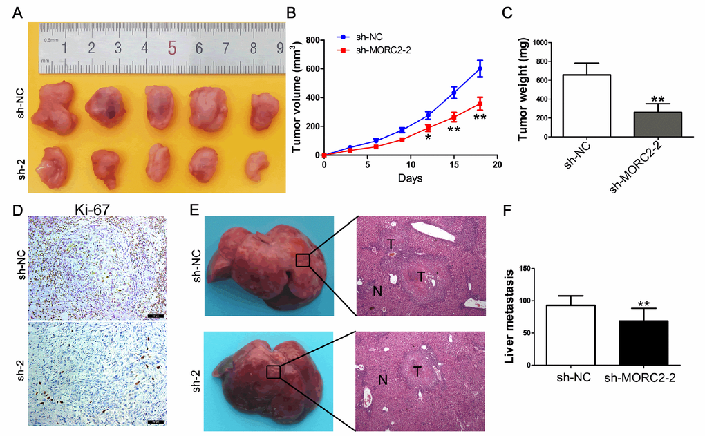 Knockdown of MORC2 inhibits tumor growth and liver metastasis in vivo. (A–C) Knockdown of MORC2 expression significantly inhibited CCA cell growth in nude mice, and the tumor weight (B) and tumor volume (C) were significantly reduced in the sh-MORC2 group compared to those in the sh-NC group. (D) Knockdown of MORC2 significantly reduced Ki-67 expression in vivo. (E) An experimental metastasis animal model was constructed by injecting MORC2 stable knockdown HuCCT1 cells into the distal tip of the spleen (Left). Representative images from each group are shown (Right). (F) The number of tumor nodules on the liver surfaces from the two groups is shown. **P 