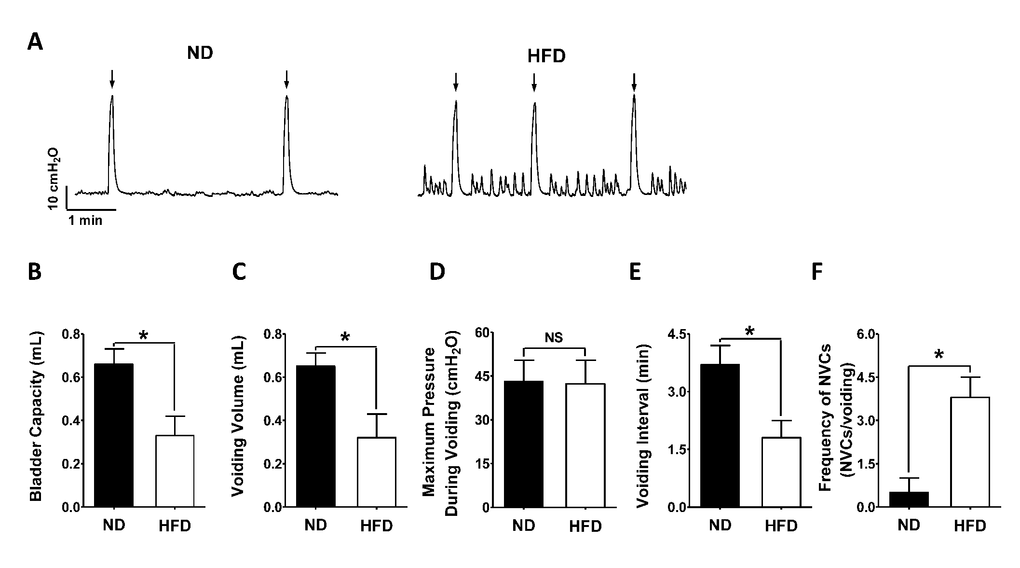 HFD feeding successfully induces detrusor overactivity. (A) Representative cystometrogram illustrating the changes in bladder function in HFD rats. A lower bladder capacity (B), smaller voiding volume (C), shorter voiding interval (E) and higher frequency of non-voiding contractions (F) were recorded in HFD rats than in ND animals. However, the maximum pressure during voiding did not differ significantly between the groups. Data are expressed as the mean ± SEM, N = 10 per group, * P NS: not significant; NVCs: non-voiding contractions. Arrow indicates the voiding peak.