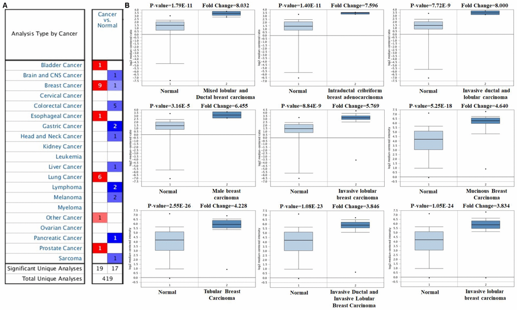 FOXA1 analysis in breast cancer (Oncomine database). The online Oncomine analysis tool (red: overexpression, blue: down-expression) was used to compare FOXA1 expression levels in breast cancer specimens with matched normal specimens. The thresholds for significant probes for each microarray dataset included a two-fold difference in expression between cancer and normal samples and P FOXA1 expression in cancer samples (right) and matches normal (left) samples generated from the Oncomine database.
