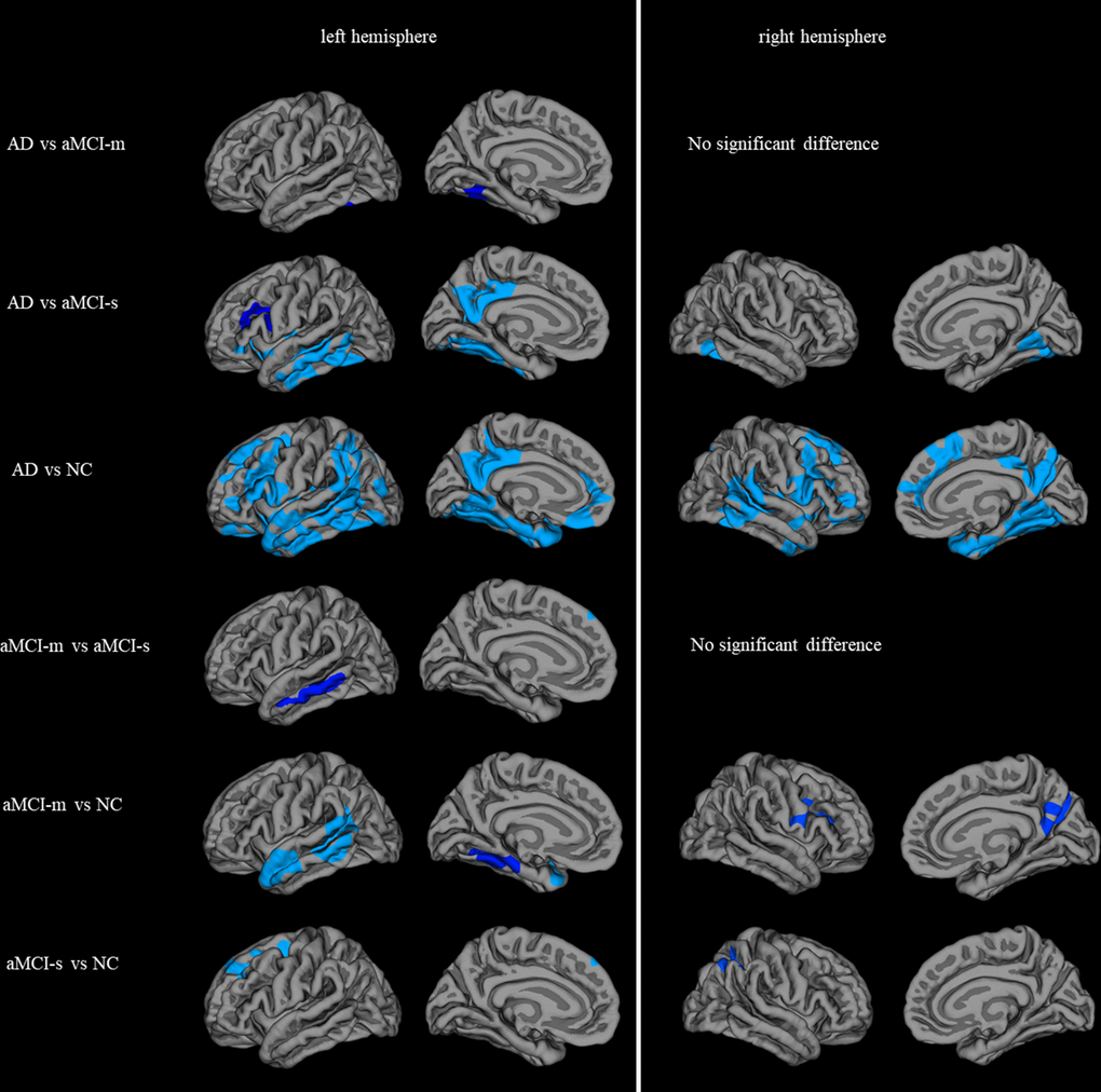 Statistically significant brain regions obtained by group comparisons between the AD, aMCI-m, aMCI-s and NC groups (Monte Carlo simulation corrected for multiple comparisons). The significance was -log(p) instead of straight p value for display purpose.