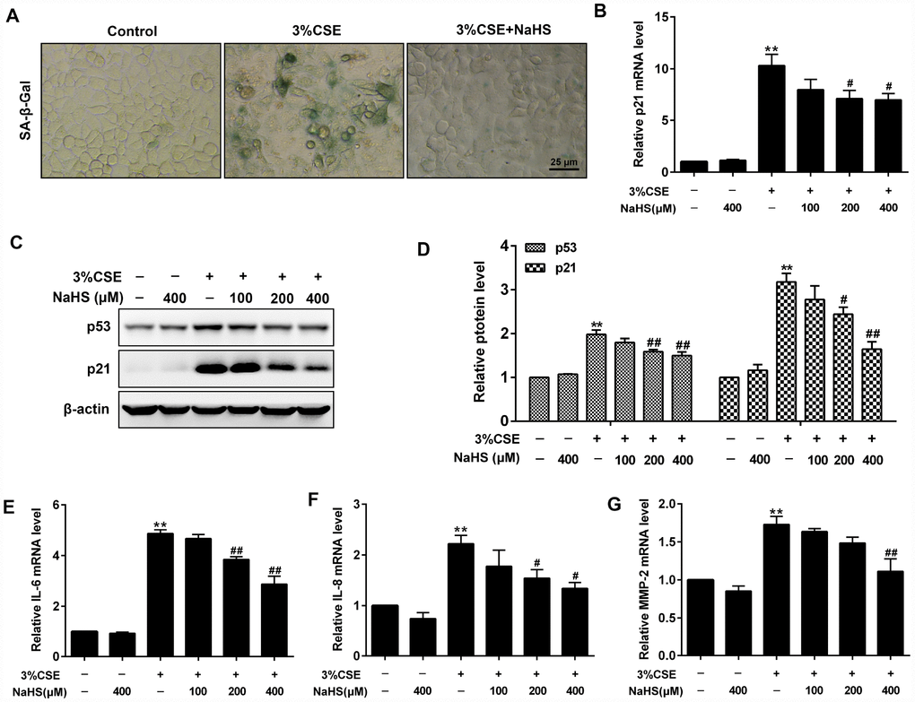 Effects of NaHS on cell senescence in CSE-stimulated A549 cells. A549 cells were cultured with and without 3% CSE and/or 100, 200, or 400μM NaHS for 48 h. Cell senescence was performed by examining the (A) the SA–β-gal activity. (B) the mRNA level of p21 by Real-time PCR. (C, D) the protein levels of p53 and p21 by Western blot. (E–G) The mRNA levels of IL-6, IL-8 and MMP-2 were detected using Real-time PCR. **P#P##P