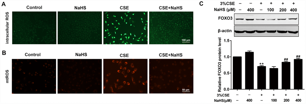 Effects of NaHS on CSE-induced oxidative stress in A549 cells. A549 cells treated with and without 3% CSE and/or 400μM NaHS for 48 h. Representative microphotographs showing intracellular ROS (A) and mtROS (B) generation respectively. (C) A549 cells were cultured with and without 3% CSE and/or 100, 200, or 400μM NaHS for 48 h. Western blot was used to analyze the protein expression of FOXO3. **P##P