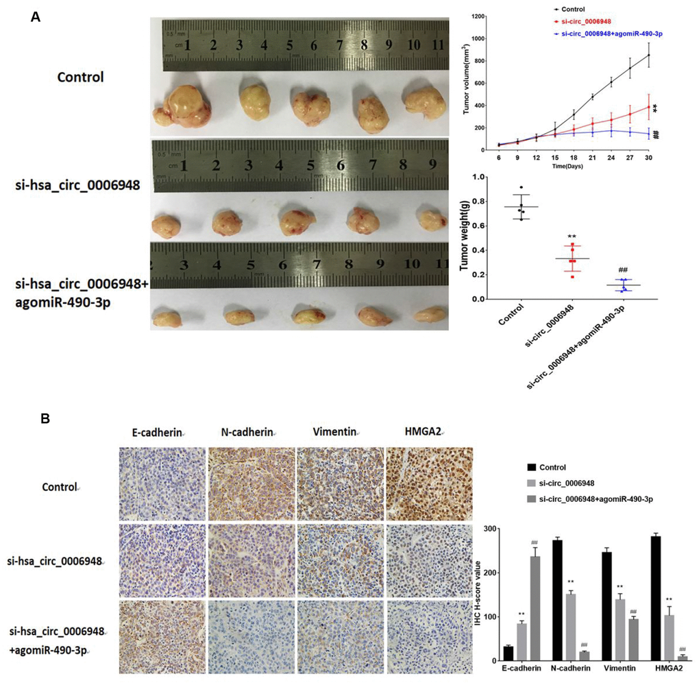 The images of tumor-bearing nude mice from three treatment groups (n = 5 for each group) on the 30th day. (A) Tumor volumes were monitored with a caliper during the time course of 30 days, and tumor weights were also measured at the end of this study.(B) IHC analysis of E-cadherin, N-cadherin, vimentin and HMGA2. **P