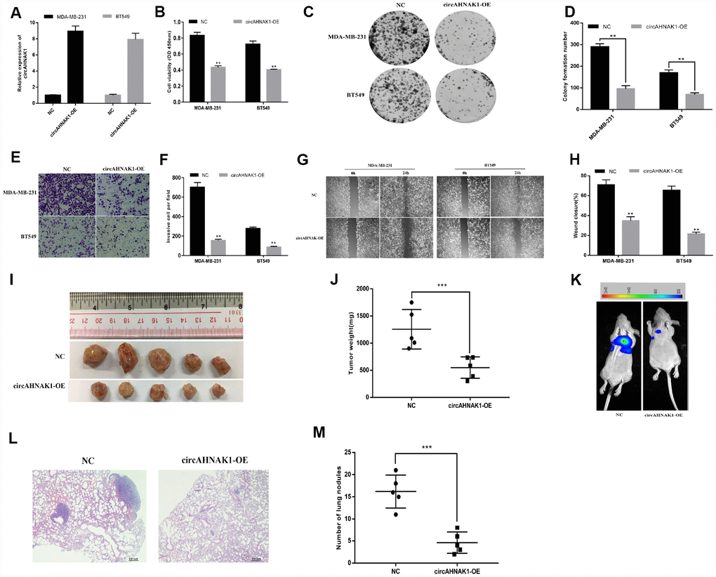 Overexpression of circAHNAK1 inhibits proliferation and metastasis of TNBC. (A)Successfully established two breast cancer cell lines that overexpress circAHNAK1; (B) CCK-8 assay to evaluate the effect of circAHNAK1 on cell proliferation; (C) Colony formation assay to evaluate the effect of circAHNAK1 on cell colony forming ability; (D) Number of clones quantified by ImageJ; (E) Transwell invasion assay to evaluate the effect of circAHNAK1 on cell invasion; (F) ImageJ quantifies the number of invading cells; (G) Wound healing assay evaluates the effect of circAHNAK1 on wound closure; (H) ImageJ quantifies the extent of wound healing; (I) Xenograft model to evaluate the effect of circAHNAK1 on tumor proliferation in vivo; (J) Effect of circAHNAK1 on proliferation in vivo by tumor weight; (K) Representative images of luciferase signaling to assess the effects of circAHNAK1 on lung metastasis in vivo; (L) Representative images of HE staining of lung metastatic nodule sections; (M) Quantification of the number of lung metastatic nodules.