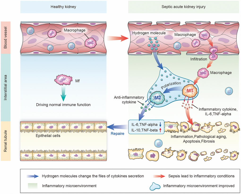 Schematic diagram of how aerosol inhalation of the HRS attenuated septic renal injury by promoting macrophage M1/M2 polarization. Normally, macrophages (Mf) perform immune functions in the interstitium of the kidney. In the case of kidney injury, the permeability of the vascular endothelial cells increases. Intravascular macrophages infiltrate the interstitial spaces and form M1-type macrophages that secrete inflammatory cytokines, thus destroying renal tubular epithelial cells. After HRS treatment, hydrogen molecules can infiltrate the tissues through the blood vessels, change the inflammatory factors that are secreted in the inflammatory environment, and promote the polarization from M1-type to M2-type macrophages. M2 macrophages secrete anti-inflammatory factors to repair the damaged renal tubules.