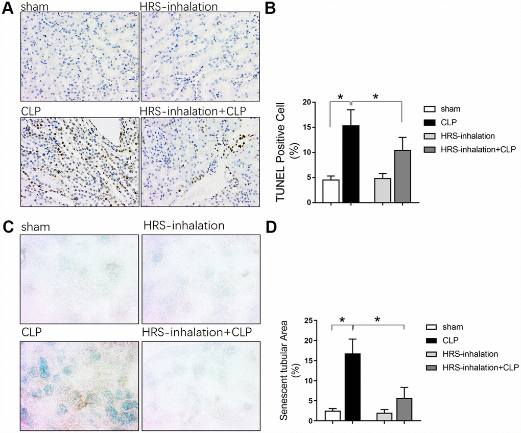 Aerosol inhalation of an HRS inhibited renal tubular epithelial cell apoptosis and senescence in septic mice. (A) TUNEL staining (×200); (B) Percentage of TUNEL-positive cells; (C) β-galactosidase staining (×400); (D) Percentage of senescent tubular area. n=6 per group. Data are shown as the mean ± SEM. In (B) and (D), significance was calculated by one-way ANOVA with Tukey’s post hoc test, *: P.