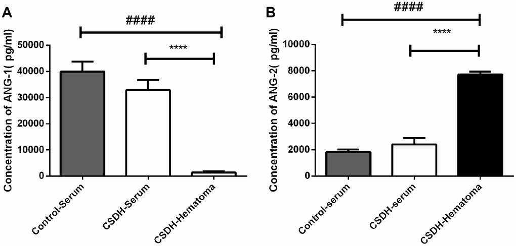 Analysis of ANG-1 and ANG-2 concentrations in serum from CSDH patients, serum from healthy controls, or hematoma supernatants. (A) No differences in the serum ANG-1 concentration were observed between CSDH patients and healthy controls. The ANG-1 concentration was lower in hematoma supernatants compared to the concentration in serum. (B) No differences in the ANG-2 concentration were observed in serum from CSDH patients and healthy controls. The ANG-1 concentration was higher in hematoma supernatants compared to in serum. Data are presented as the mean ± SEM. **** p 